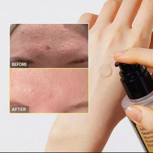 COSRX Advanced Snail 96 Mucin Power Essence 100 ml